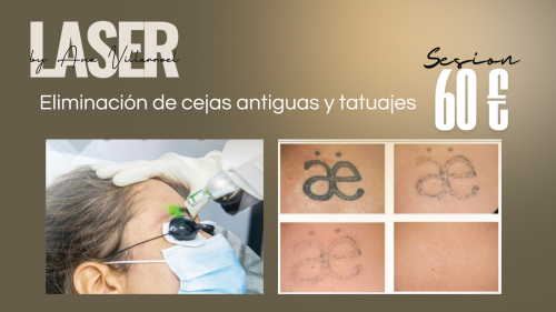 Foto Micropigmentacion Huelva